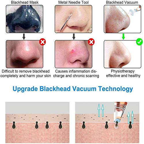 profectlen Acne Отстраняване на Електрически Пречистване на Още Прахосмукачка За черни точки на Носа за Пречистване За